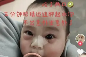 网红说法求真｜7个月宝宝吃猕猴桃经历“断崖式衰老”，“四岁前不能吃猕猴桃”是真的吗？图片