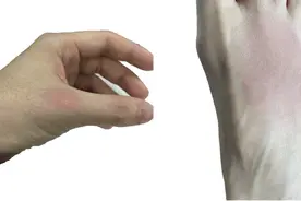 罕见病科普图片