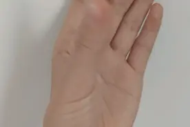 这些表现提示老年痴呆将至，对照自查！简单的健脑方法，尽早用起来图片