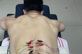 扎过的针装满5升水桶！石智勇回应：拼过不后悔！图片