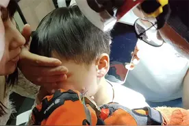 这位长沙宝爸心可真大，钓鱼甩钩挂到儿子的脸上图片