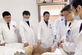 小腿围缩小7cm，体重下降34斤多！360斤“大象腿”患者成功获救图片