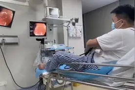 太拼了！广州医生无麻醉给自己做胃肠镜，原因竟是……图片