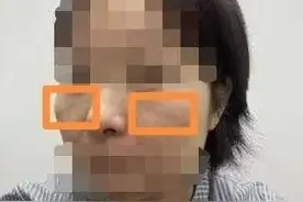 聚焦3•15｜做了医美项目效果不明显？南京一美容机构：可免费注射玻尿酸补偿图片