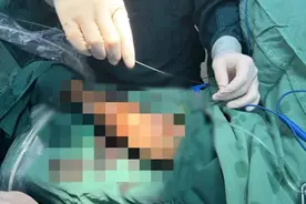 抬手一挡，无人机切断了他透析的“生命线”图片