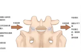 骨折可以"静悄悄"？警惕骨质疏松性椎体压缩骨折图片