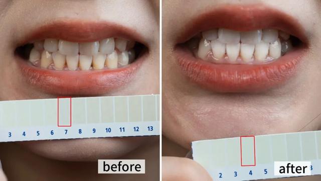 咖啡是白天喝的	，牙是夜里变黄的