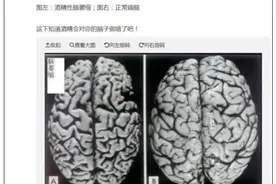 天天喝酒的人会得什么病？研究发现：经常喝酒最伤这2个器官！图片
