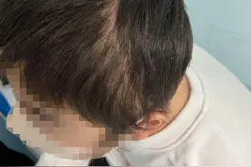 【罕见病】多发性大动脉炎图片
