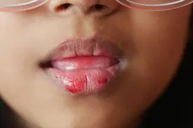 今日健康丨嘴唇干又起皮，难道是水喝少了？图片