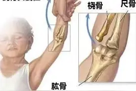 健康小站 | 牵牵衣角，宝宝手臂就疼，原来是桡骨小头半脱位了图片
