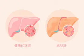 ＠中老年人群：拒绝盲目减肥！科学减重这样做图片