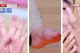 偷偷升高你尿酸的帮凶，不只是嘌呤！还有这种蔬菜成分被忽视了…图片