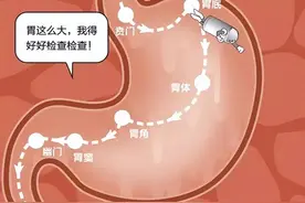 经常打嗝，疑是胃癌？专家：这种嗝要当心图片