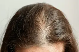 4个无意间的行为，正在加重你的脱发！第3个很多人都中招了图片