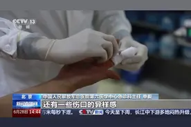 狂犬病传播不止于“犬” 伤口没出血也要打疫苗图片