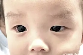 泰国一半岁男婴，眼睛突然变成亮蓝色图片