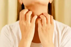 身上长“小疙瘩”？千万别乱抠！这三种可能是“大病”在预警！图片