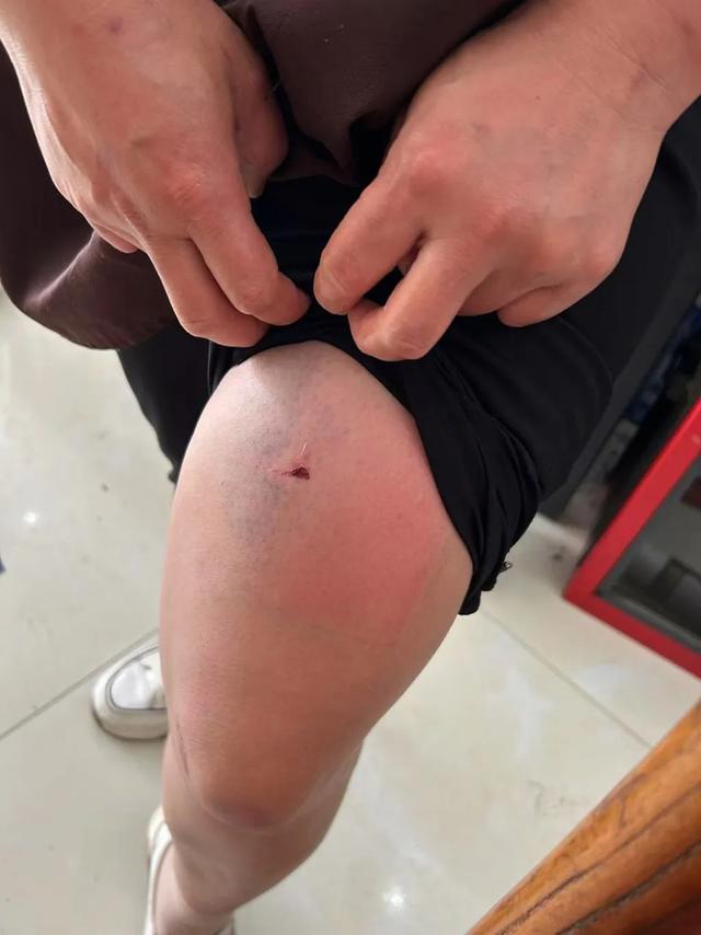 云南一男子怀疑妻子出轨凌晨逼问并施暴，被警方行拘4日，妇联：女方不调解坚决离婚，建议她起诉