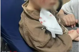 3岁男童被犬咬伤18天后不幸离世，谁该对此负责图片