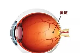 爱尔科普：传说中“明目护眼”的叶黄素，真的能预防近视吗？图片