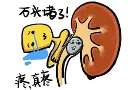 结石也分“门派”？成分不同，治法大不同！图片