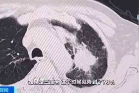 早期大多无症状！我国恶性肿瘤发病率首位，是它→图片