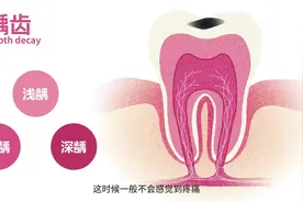 科普视频 | 牙痛揭秘：原来牙痛有这么多种原因！图片