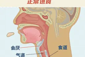 吃饭喝水老是呛？原来是因为……图片