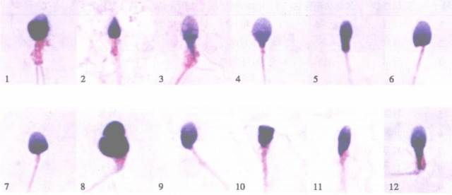 精子界的“黑神话悟空”：揭秘精子形态选美大赛