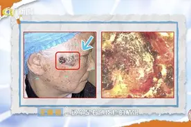 预告｜名医大会诊：“医”心为肤展新颜图片