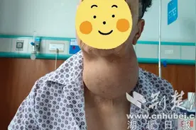 百年总院有绝招｜七旬老人脖子肿物大如球 东总专家妙手除包块图片
