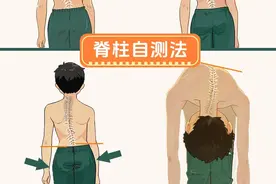 关注脊柱侧弯，守护青少年健康！图片