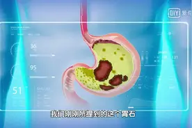 正在街头热卖的2种食物，千万别一起吃！特伤胃，严重时可致命！图片