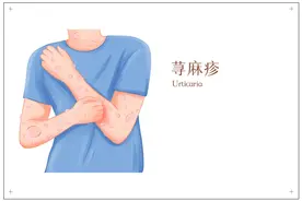 身上一热就起痒疙瘩，怎么办 | 科普时间图片