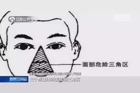 八龄童抠鼻险丧命！很多人还天天这样做图片