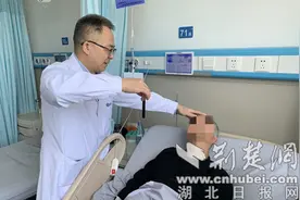 男子摔跤后眼睛外突视物重影 太和专家精准揪出元凶助其康复图片