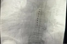 近期多发！这种病老年人易得，痛起来要命图片