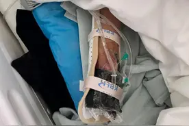 意外！孩子手指被炸伤，看着都疼！图片