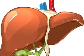 肝脏结节=肝癌？No！No！No！图片