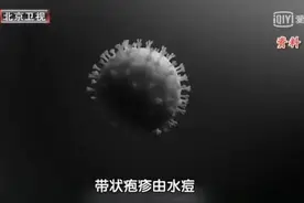 95%以上的人身上都可能藏匿这种病毒！年龄越大越易发作，早知道早预防图片