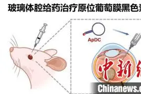 中国创新药研究获美国官方机构认定 将助力全球眼部肿瘤罕见病治疗图片