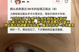 女子做手术取出戳进额头20年铅笔芯，长皮肤里有一小块黑色，当事人回应：应该是2B铅笔芯，还可以写字图片