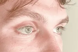 三维打印让义眼更逼真更自然图片