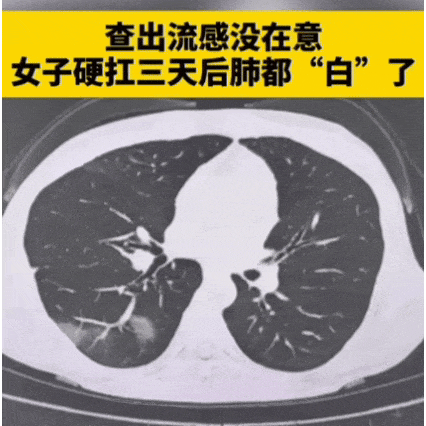 已确认！毒株变了！传染性更强	、传播速度更快！千万别忽视，有人“硬扛”3天竟出现“白肺”