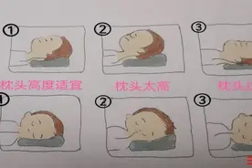 一觉醒来脖子疼痛、僵硬，“落枕”了这么办图片