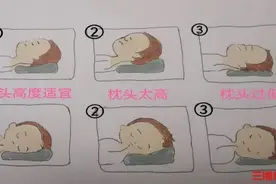 一觉醒来脖子疼痛、僵硬，“落枕”了这么办图片