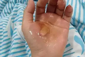 女子洗澡险丢命，只因家中缺少这一装置……图片