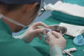 移花接木肋软骨变右耳 东方整形科6小时帮女孩“找”回耳朵图片