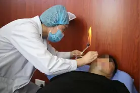 传岐黄之术  她妙手轻舞银针 守护百姓健康图片